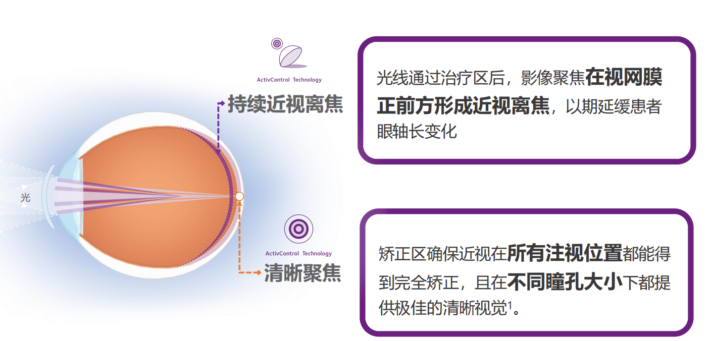 平均售价上千元，这款“近视防控神器”走红