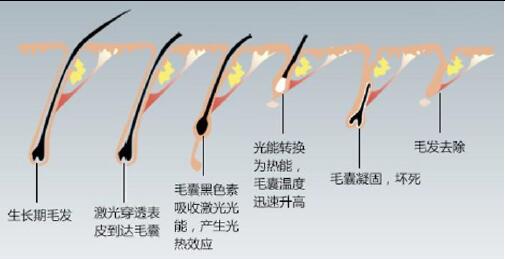 毛发医疗概念涨3.82%，主力资金净流入10股