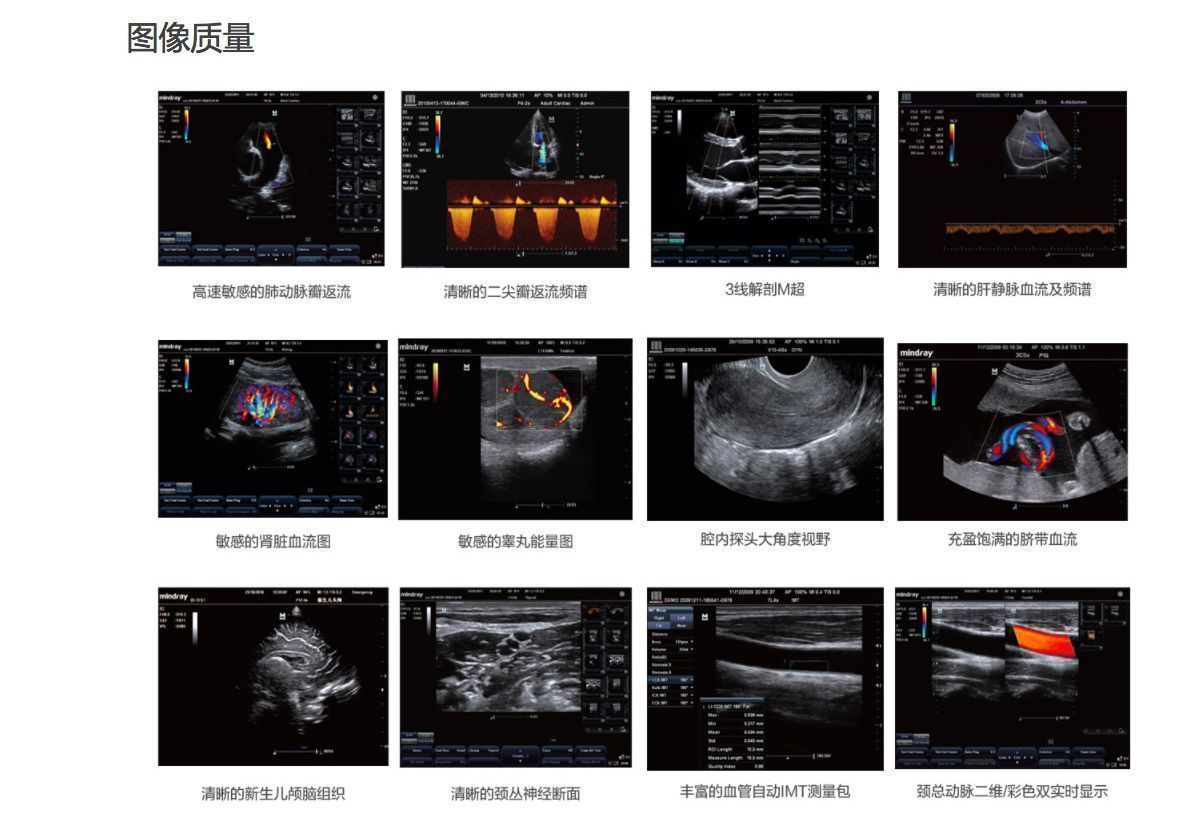迈瑞医疗获得发明专利授权：“频谱分析方法和超声成像系统”