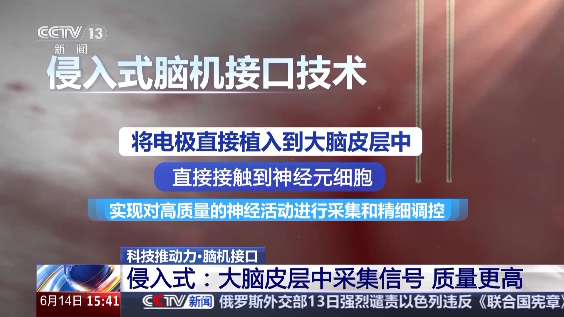 机构：脑机接口行业加速创新