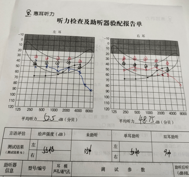 报告：我国60岁以上老年人患听力损失人数超2000万