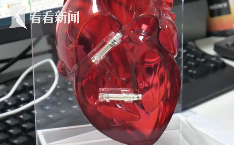 不用换电池的无导线心脏起搏器研发成功