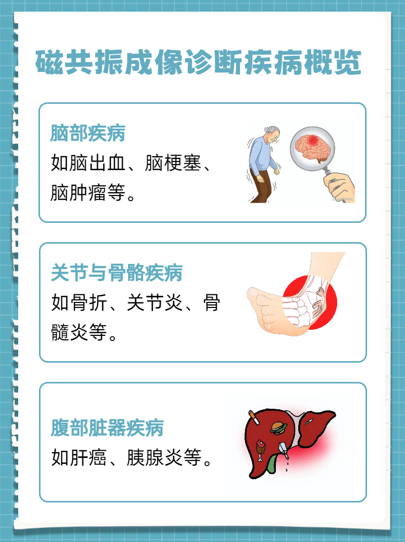 联影医疗获得发明专利授权:“一种磁共振图像引导的放射治疗系统”