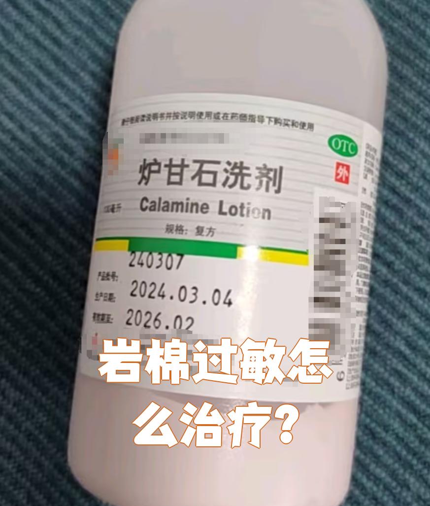 专家:皮肤过敏千万不要轻信“网红止痒神药”